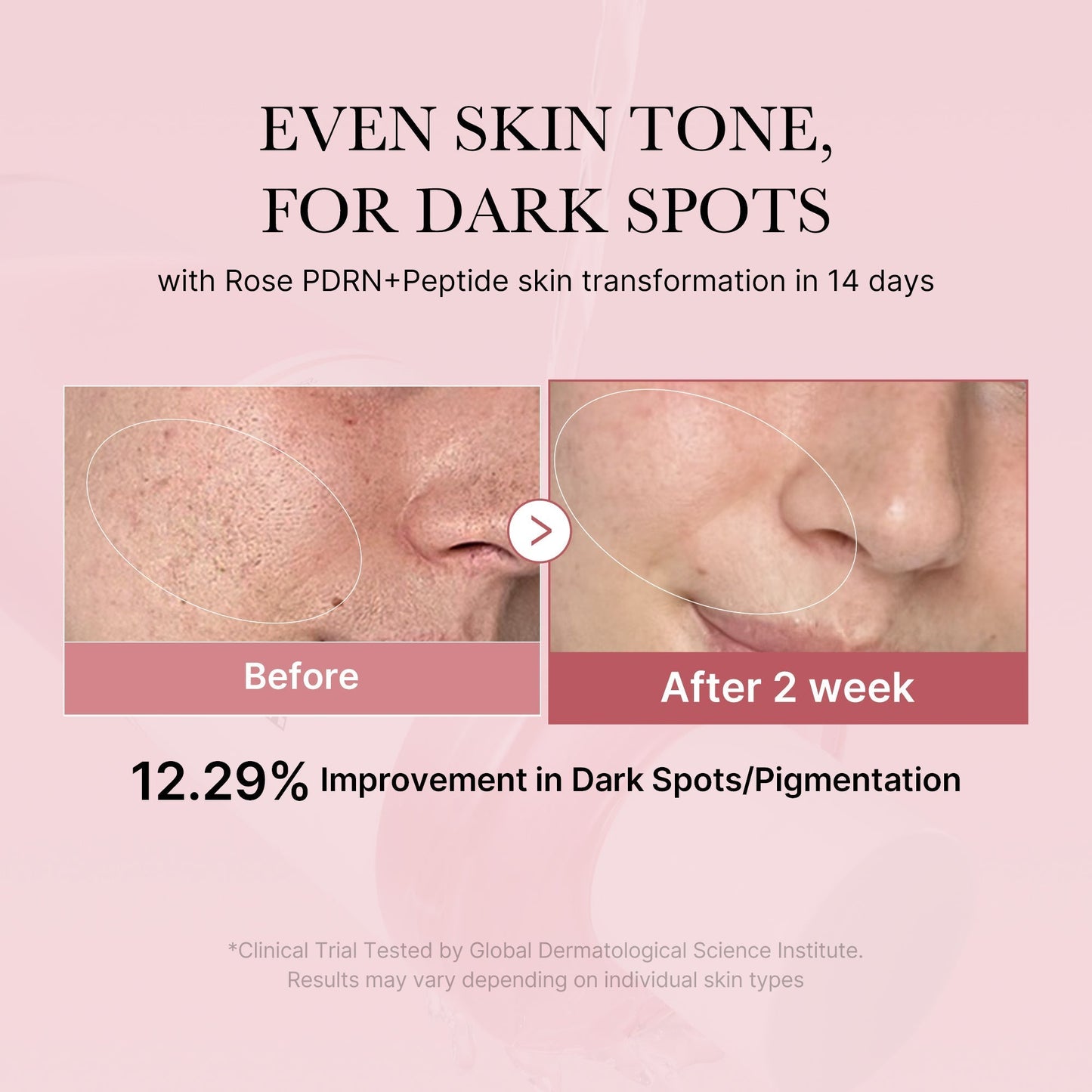 PDRN Pink Toner