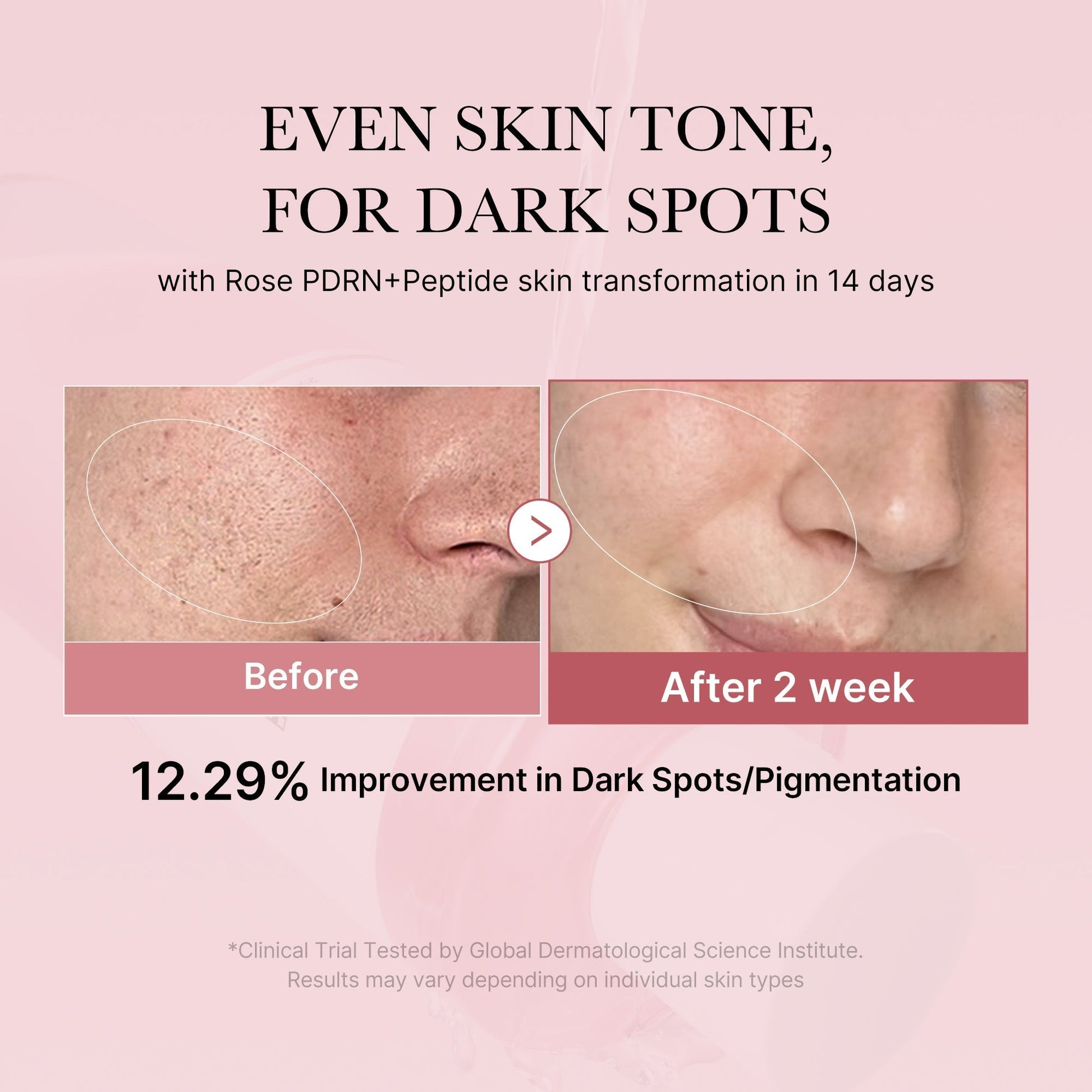 PDRN Pink Toner