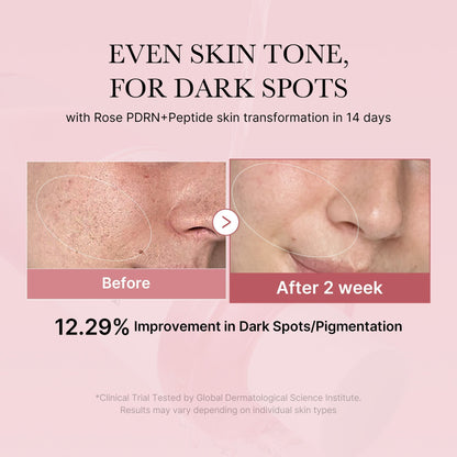 PDRN Pink Toner