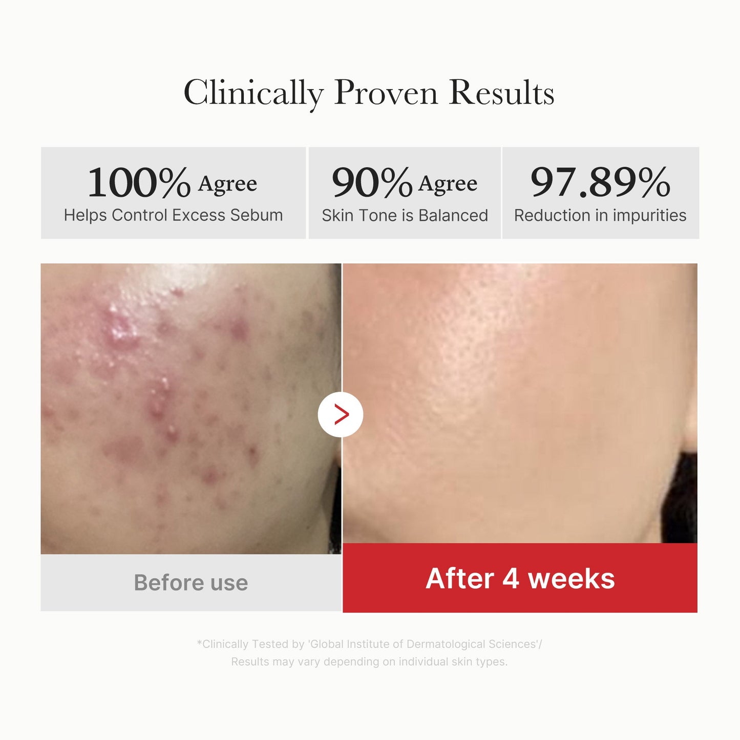 Ampoule d'acide succinique rouge