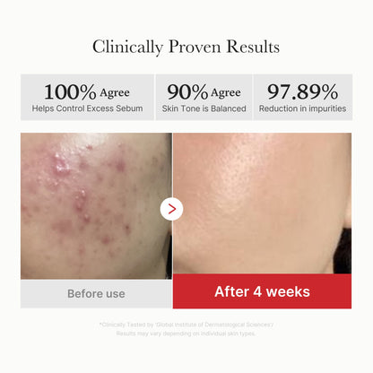 Gel d'acide succinique rouge