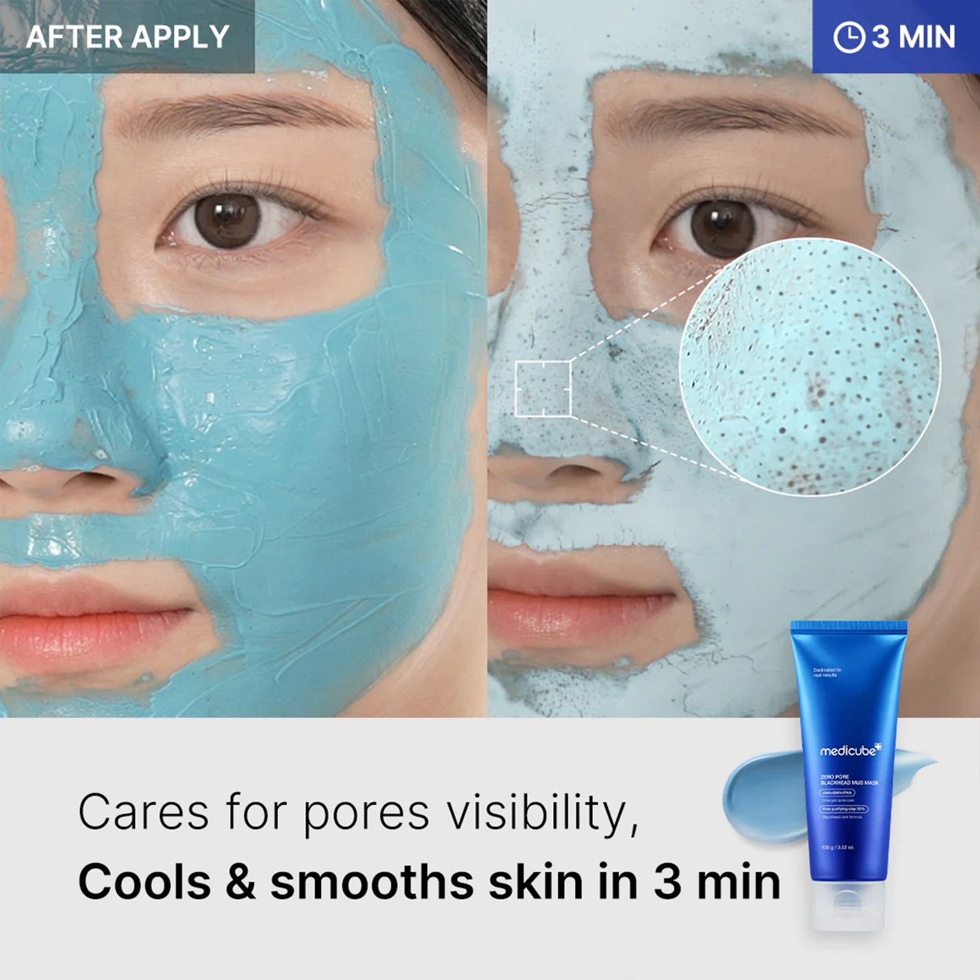Masque de boue points noirs zéro pores