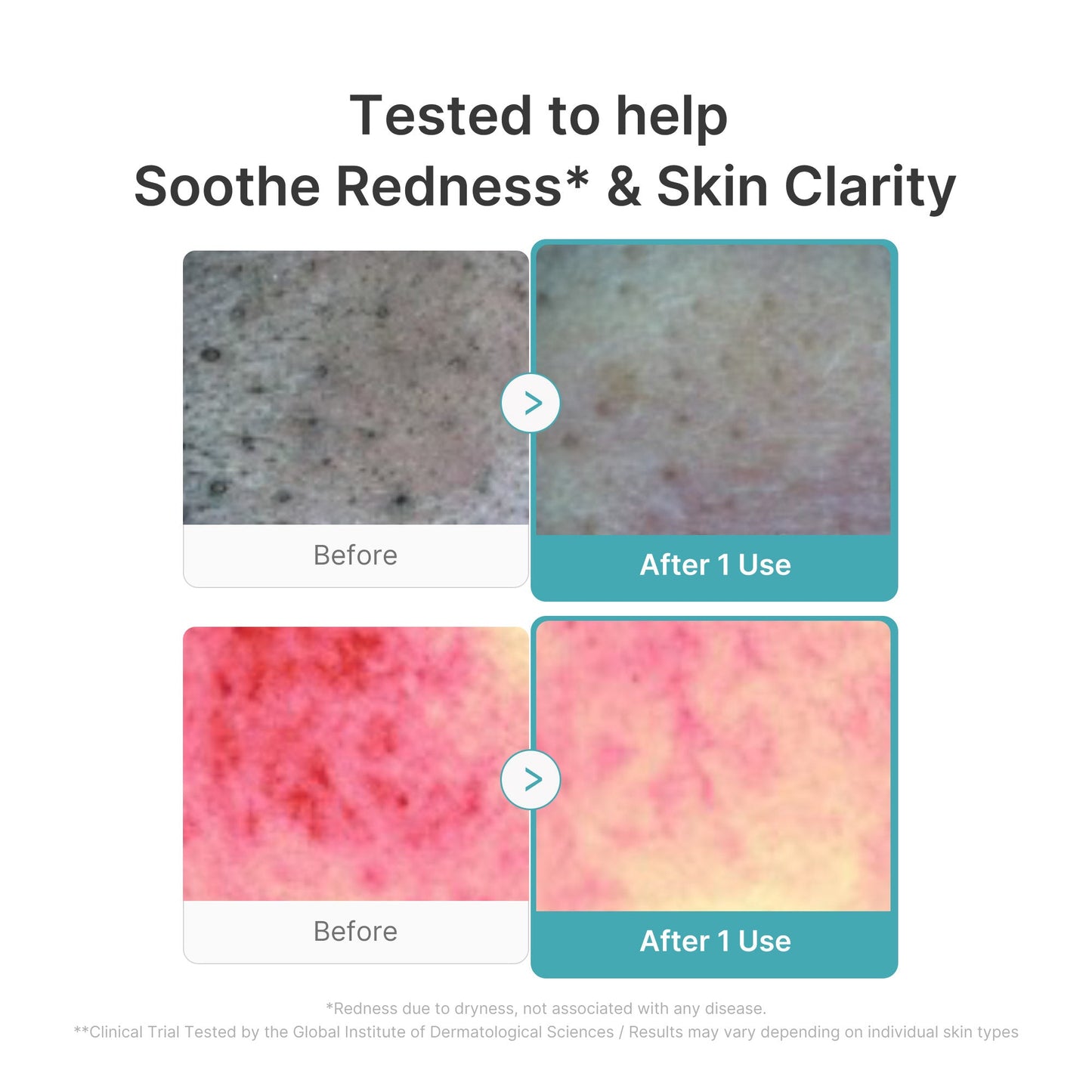 Mousse nettoyante à l'acide succinique rouge