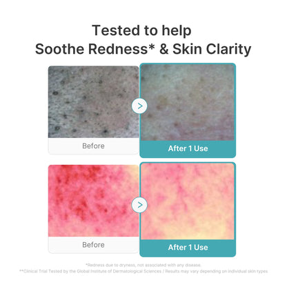 Mousse nettoyante à l'acide succinique rouge